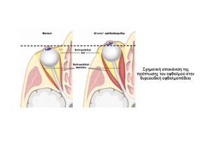Νέο Παρουσίαση του Microsoft PowerPoint
